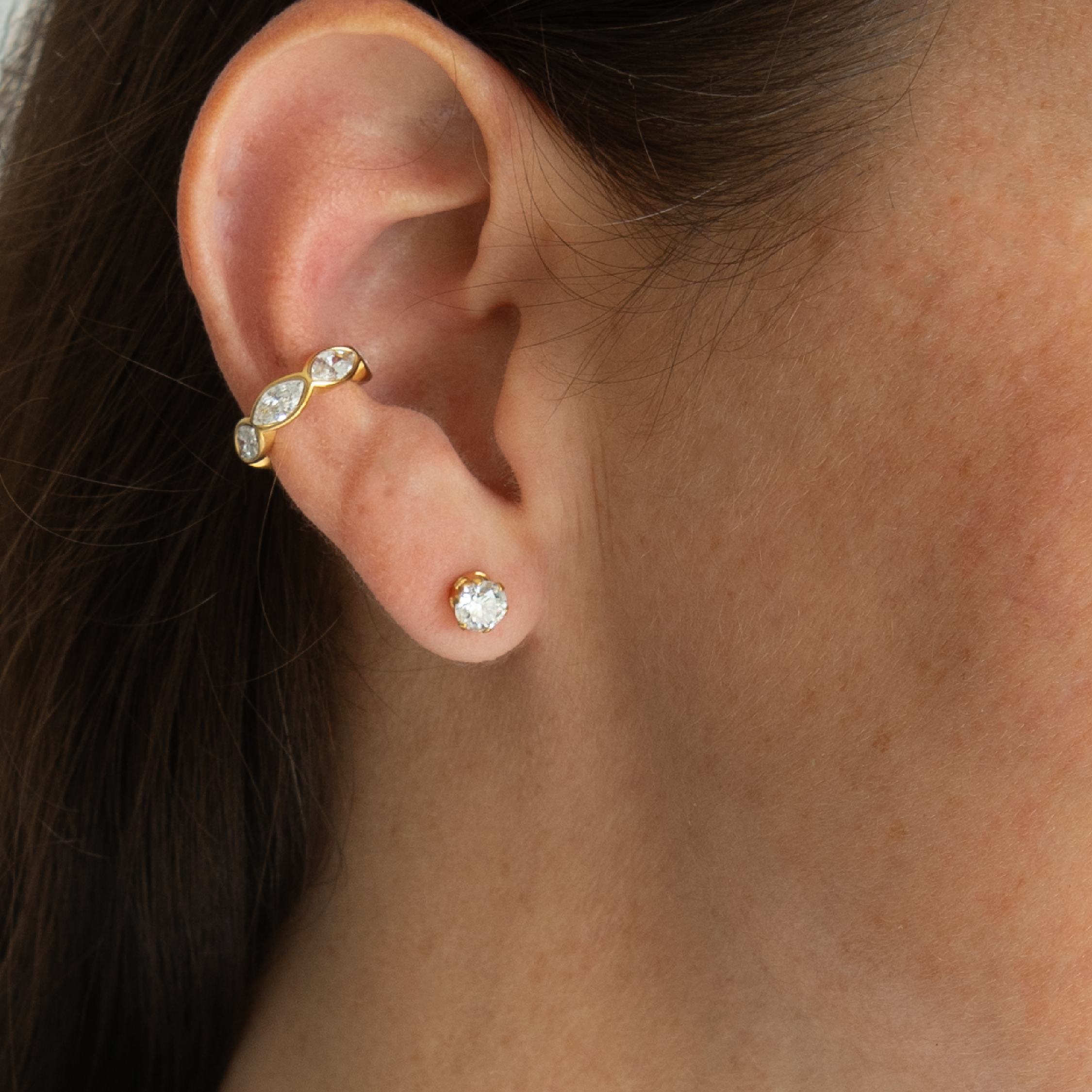 ARETES ALBA